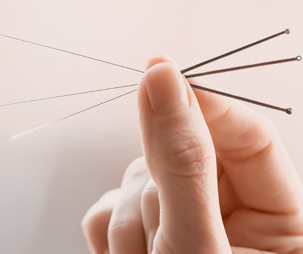 Despre acupunctura